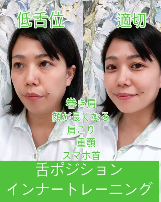 ブログ画像